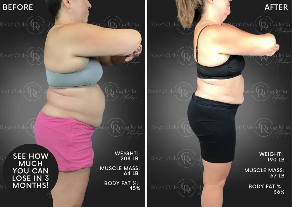 Before and after weight loss transformation with ROG Medspa Houston