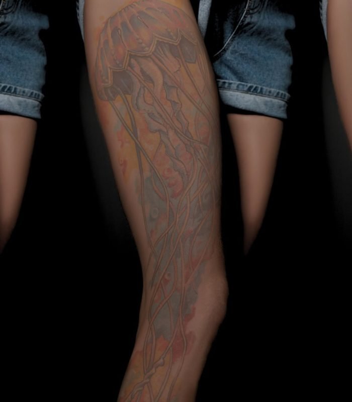 Laser Tattoo Removal Houston - Progress pictures of leg tattoo